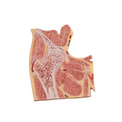 דגם מפרק ירך